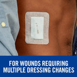 Nexcare String Hold Adhesive Pads 3" x 4" 4ct