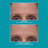 Peter Thomas Roth Peptide Skinjection™ Amplified Wrinkle-Fix Serum Refillable Intensive Firming Serum for Instant Smoothing of Wrinkles Refillable 3