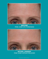 Peter Thomas Roth Peptide Skinjection Refill Amplified Wrinkle Fix Serum 1 oz