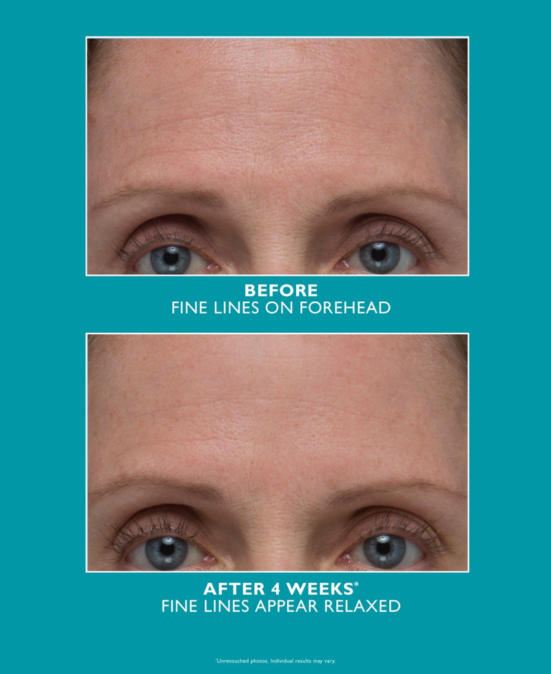 Peter Thomas Roth Peptide Skinjection Refill Amplified Wrinkle Fix Serum 1 oz