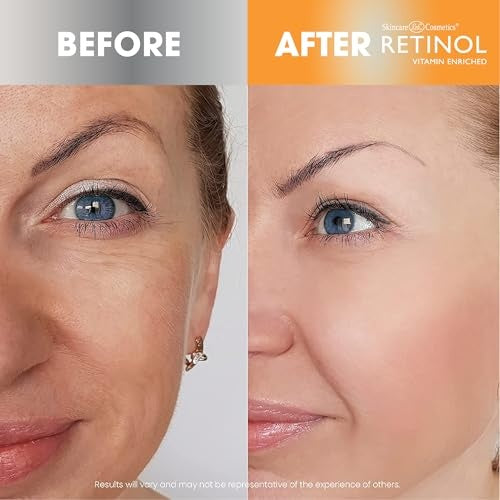 Retinol +Vitamin C Dark Spot Corrector 15g