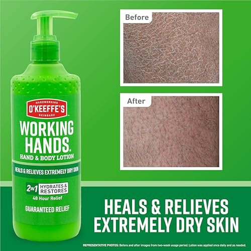 O'Keeffe's Working Hands Lotion for Dry Skin 12oz