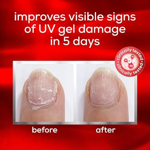 Essie to the Rescue Nail Repair Treatment, 0.46 Fl Oz