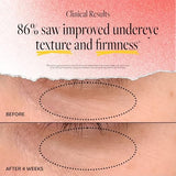 Derma E Anti-Wrinkle Retinol Line Smoothing Hydro Gel Eye Patches, 5 Count