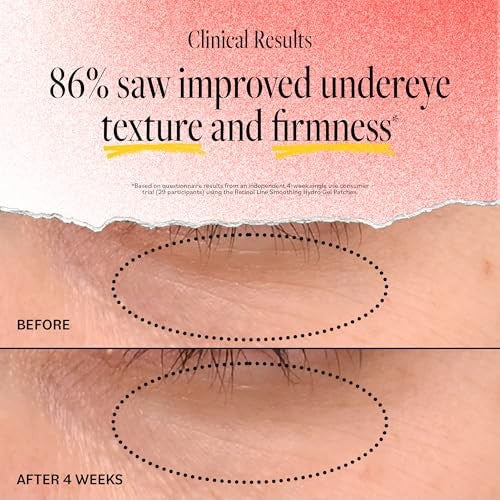 Derma E Anti-Wrinkle Retinol Line Smoothing Hydro Gel Eye Patches, 5 Count
