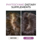 Phyto Phytocyane Hair Densifying Dietary Supplement