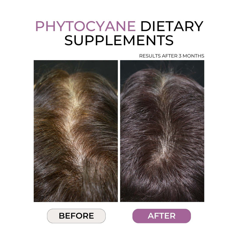 Phyto Phytocyane Hair Densifying Dietary Supplement