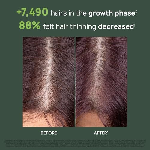 Rene Furterer Triphasic Progressive Concentrated Serum for Hereditary