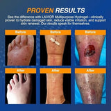 Lavior Multipurpose Hydrogel for Cuts, Scrapes, Burns & Wounds 1 Fl Oz