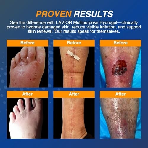 Lavior Multipurpose Hydrogel for Cuts, Scrapes, Burns & Wounds 1 Fl Oz
