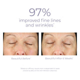 Derma E Anti Wrinkle Treatment Renewal Cream 4oz