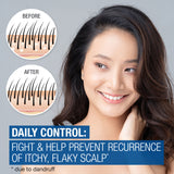 Neutrogena Scalp Therapy Anti-Dandruff Shampoo Daily Control 12 oz