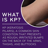AmLactin KP Bumps Be Gone Lotion 3 oz
