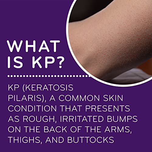 AmLactin KP Bumps Be Gone Lotion 3 oz