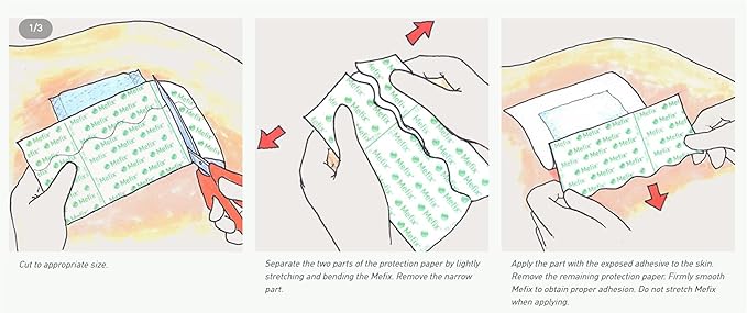 Mefix Self-Adhesive Fabric Dressing Fixation Tape 4" x 11 yd