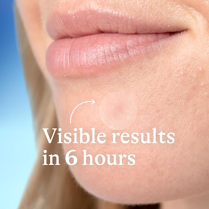 Differin Acne Prone Skin Patches 36ct