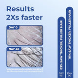 BosleyMD Mens Revive+ Densifying Foam for Hair Regrowth, 2 Month Supply