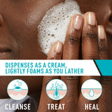 Cerave Acne Foaming 4% Benzoyl Peroxide Cleanser 5oz