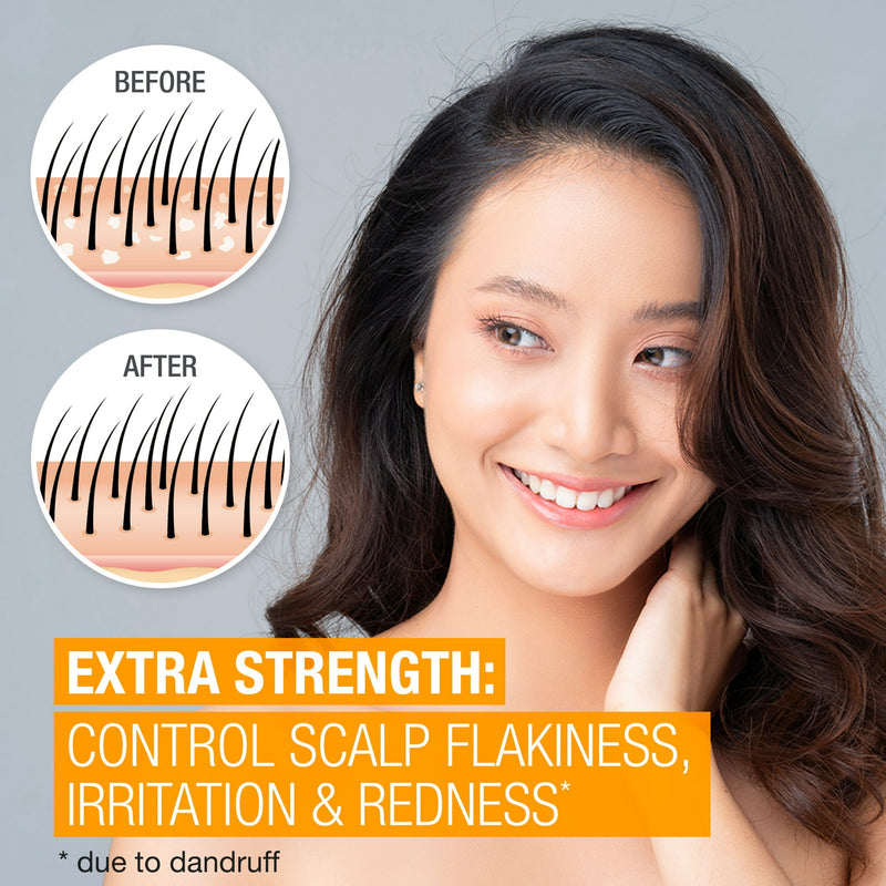 Neutrogena Scalp Therapy Extra Strength 12Oz