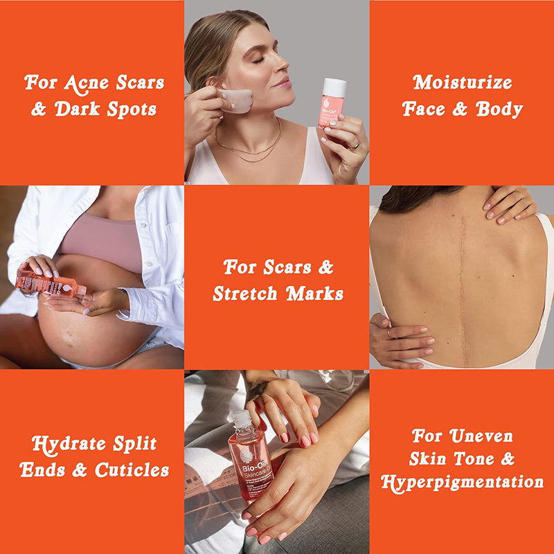 Bio-Oil Skincare Oil - 2.0 fl oz Bio-Oil Skincare Oil - 2.0 fl oz