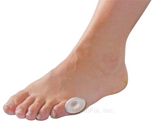 PediFix Pedi-GEL Corn Cushions